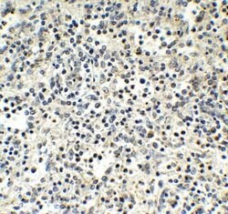 MNDA Antibody - BSA Free, Novus Biologicals 0.1 mg | Buy Online | Novus Biologicals | Fisher Scientific